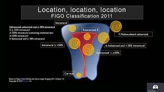 Ultrasound of the Myometrium by Mindy H Horrow MD FACR FSRU FAIUM [upl. by Souvaine]