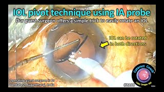 CataractCoach™ 2108 IOL pivot technique using the IA probe [upl. by Terces]