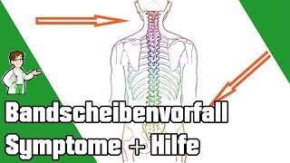 Bandscheibenvorfall Symptome  10 Maßnahmen um ihn zu beheben ✅ [upl. by Donatelli]