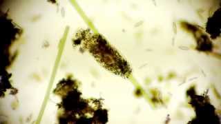 amoeba limax  Amöbe  microcosmos under a microscope  microorganisms in 1080p Full HD [upl. by Mcripley]