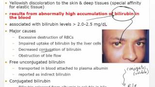 Chapter 30 Video Disorders of Hepatobiliary Liver and Pancreatic [upl. by Rubel]