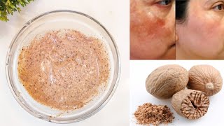 Acne Scars and Hyperpigmentation Removal NutmegJaiphal Face Pack to get Clear amp Spotless Skin [upl. by Junieta956]