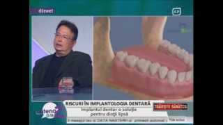 Riscuri in implantologia dentarawmv [upl. by Kacie]