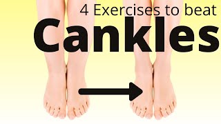 4 exercises to define your calves  lose cankles fast [upl. by Dorolisa]