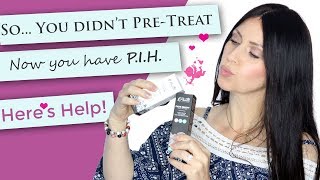 So You have PIH  Chemical Peel Help  Dark Skin  Hyperpigmentation Treatment  Pretreatment [upl. by Hilaire]