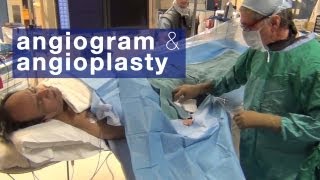 Angiogram amp angioplasty what to expect [upl. by Eissirhc]