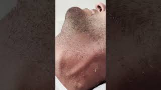 Neck Waxing  Mens Neck Waxing  Smooth Neck [upl. by Ahsienet226]