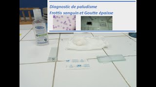 Diagnostic de paludisme  Frottis sanguin et Goutte épaisse [upl. by Patterman]