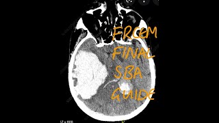 FRCEM Final SBA Guide [upl. by Reinert]