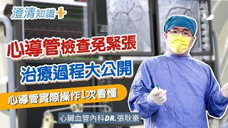 【澄清知識＋】心導管檢查 治療過程大公開心臟血管內科 張耿豪醫師 [upl. by Anastatius]