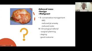 Ultrasound assessment of adnexal masses in malignancy prediction [upl. by Nguyen]