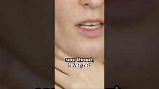 Strep Throat 101  Doctor Tips [upl. by Llennhoj]