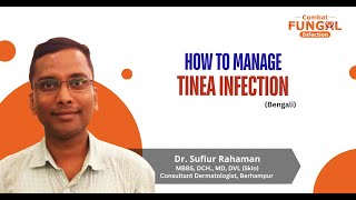 How to manage Tinea infection  Dr Sufiur Rahaman Consultant Dermatologist Berhampur Bengali [upl. by Htnnek52]