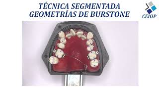 ☑️Técnica Segmentada Geometrías de Burstone I Dr Hugo Luque L [upl. by Alejo]