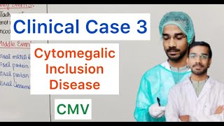 Clinical Case 3  Cytomegalic Inclusion Disease  CMV [upl. by Serilda]