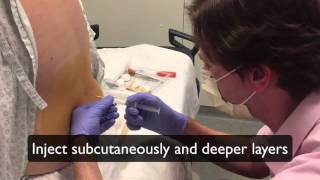 How to perform a lumbar puncture Lumbar puncture in the emergency department setting [upl. by Mariko]