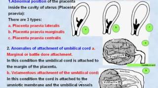 35 General Embryology Anomalies of Placenta [upl. by Bathulda]