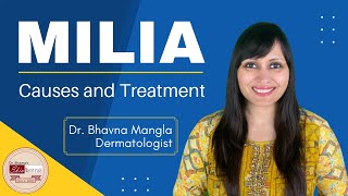 Milia removal treatment  Dermatologist  Skin specialist [upl. by Ramedlab]