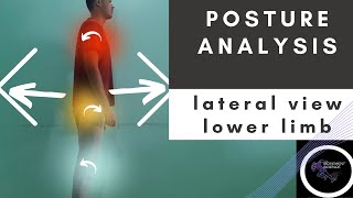 POSTURAL ANALYSIS LATERAL VIEW LOWER LIMB Posture BiomechanicsPhysiotherapy Tutorial [upl. by Nnayllek]