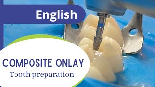 Composite onlay  pat 1 tooth preparation [upl. by Allesig]