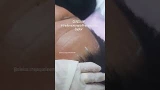 Curso Vip de Intradermoterapia Pressurizada  Tratamento Capilar estetica esteticista beleza [upl. by Ambrogio508]