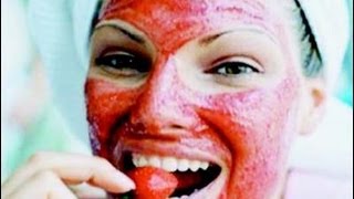 Mascarilla de fresa para el acné  Strawberry Acne Face Mask [upl. by Rimas]