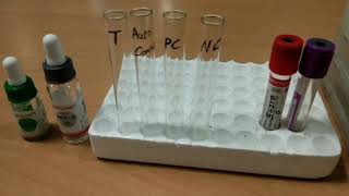 Indirect Coombs test by Tube method [upl. by Annavoj794]