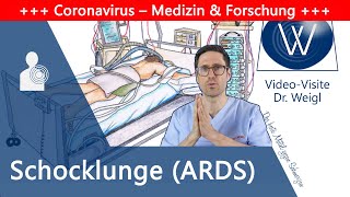 ARDS Akutes Lungenversagen durch Coronavirus amp Influenza – Schocklunge als gefährliche Komplikation [upl. by Nehemiah]