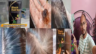 dont use black hair dye shampoo 3 in 1  honest review [upl. by Nehtanoj]