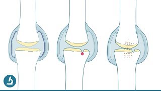 Starke Gelenke 💪 Was macht das Knie gesund und glücklich [upl. by Nitz]