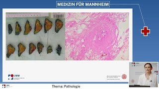 Wofür braucht der Patient einen guten Pathologen Klinische Beispiele [upl. by Anegal836]