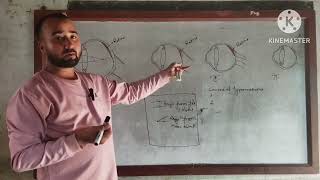 Class10 Science Myopia and Hypermetropia with their Correction [upl. by Nospmoht]