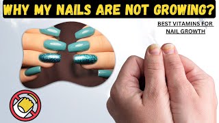 Struggling with Nail Growth Here’s Why and How to Fix It [upl. by Clayborn]