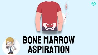 Bone marrow Aspiration and Biopsy Procedure explained [upl. by Autumn]