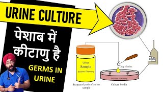 Urine Culture amp Sensitivity Test Explained  urine infection DrEducation [upl. by Sukul]