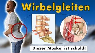 Gleitwirbel Wirbelgleiten wegtrainieren  GENAUE Ursache und 1 Übungen die NACHHALTIG hilft [upl. by Hulton]