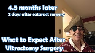 Retina Road to Recovery after Vitrectomy Surgery 45 months later [upl. by Gusta]