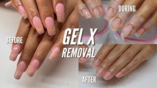 HOW TO REMOVE GEL X NAILS AT HOME [upl. by Harrak427]