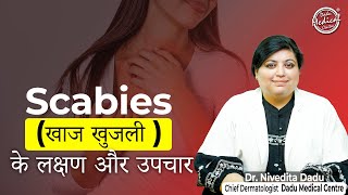 Scabies Treatment Causes Symptoms In Hindi  स्केबीज़ का इलाज कारण लक्षण  Dadu Medical Centre [upl. by Mw440]