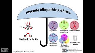 The Spectrum of Still’s Disease Genetics and Overlap with Autoinflammatory Diseases Part 2 [upl. by Fulviah]