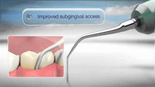 Cavitron ® FSI Slimline Einsätze  Subgingivale Behandlung [upl. by Anaic614]