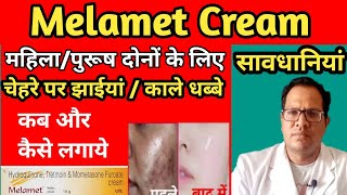 Melamet Cream  Melasma  Uses  Side effects  Review  Melamet Cream Remove Pigmentation [upl. by Essilem]