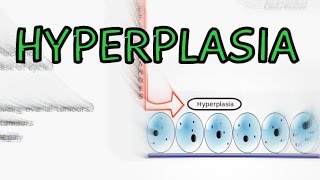 Hyperplasia  Physiological vs Pathological  Explained in 2 Minutes [upl. by Arretal]