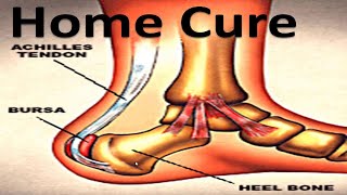 Heel Bursitis amp Achilles Tendon Bursitis Best HOME Treatment [upl. by Aniez]