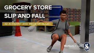 Customer Sustains Cervical Injuries In Grocery Store Slip and Fall [upl. by Atinauq852]