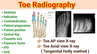 Toe Radiography  Toe AP view xray  Toe Axial view xray  Foot Projection  By BL kumawat [upl. by Olive397]