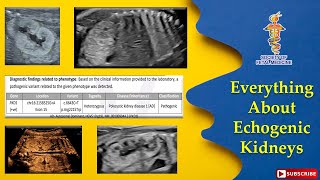 Everything about Echogenic Kidneys [upl. by Darra]