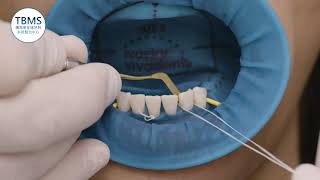 Ivoclar Vivadent 立體橡皮障 OptraDam Plus [upl. by Ashok]