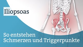 Iliopsoas Schmerzen Triggerpunkte und deren Aktivierung [upl. by Iow74]