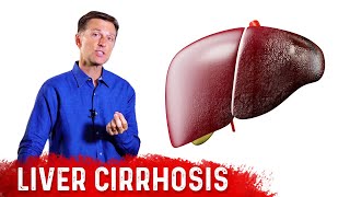 Is Liver Cirrhosis Reversible  Fibrosis vs Cirrhosis – DrBerg [upl. by Aluin240]